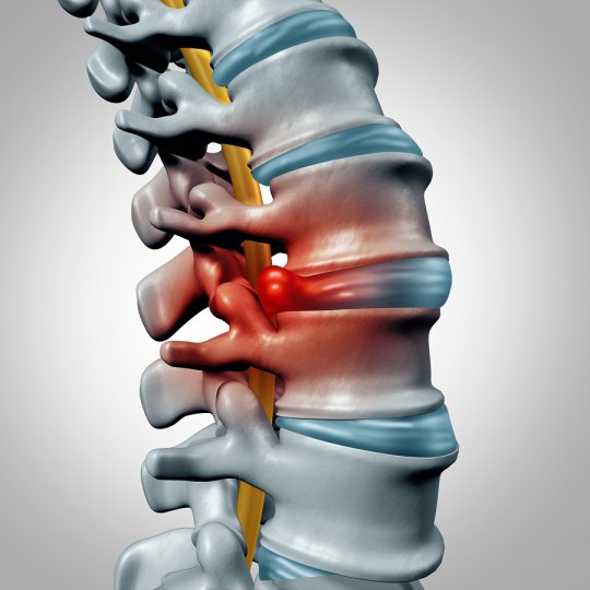 Thoracic Spine Conditions