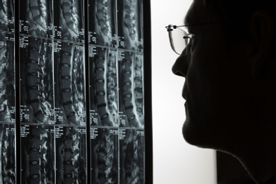 Doctor looking at MRI, Las Vegas