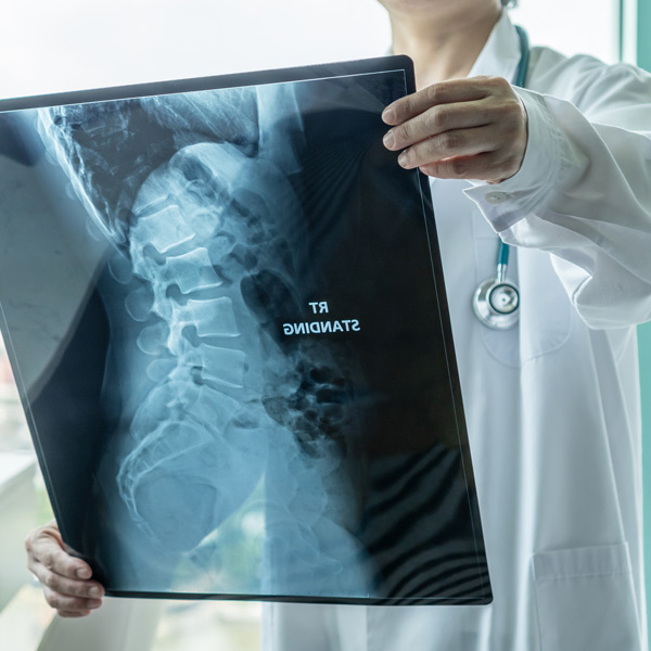 doctor holding x-ray of back