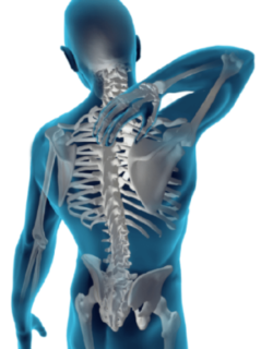 Chiropractic management of post spinal cord stimulator spine pain