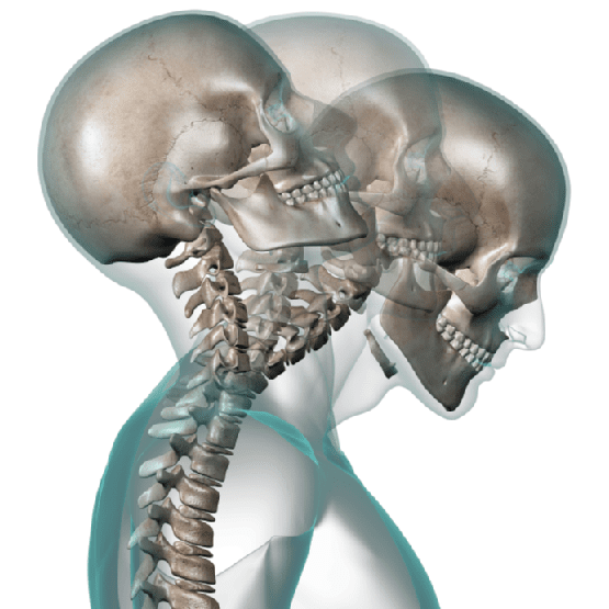 X-ray of Human Head Showing Neck Contortion, Las Vegas