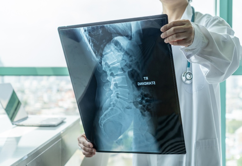 Lumbar Spine Stenosis in Las Vegas, NV